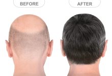 buy mens hairpieces